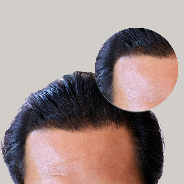 Male 3 After