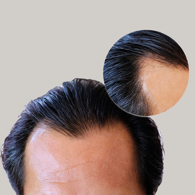 Male 3 Before