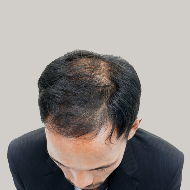 Male1Before